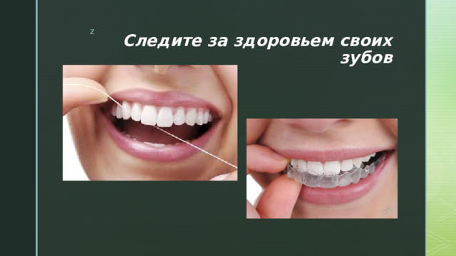 Следите за здоровьем своих зубов 