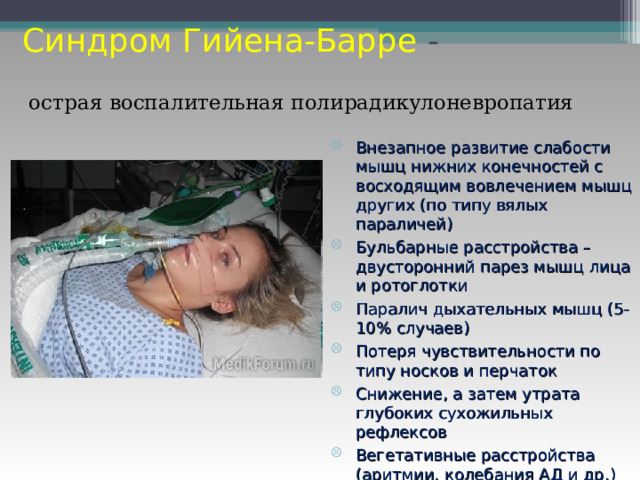 Синдром Гийена-Барре - острая воспалительная полирадикулоневропатия Внезапное развитие слабости мышц нижних конечностей с восходящим вовлечением мышц других (по типу вялых параличей) Бульбарные расстройства – двусторонний парез мышц лица и ротоглотки Паралич дыхательных мышц (5-10% случаев) Потеря чувствительности по типу носков и перчаток Снижение, а затем утрата глубоких сухожильных рефлексов Вегетативные расстройства (аритмии, колебания АД и др.) 