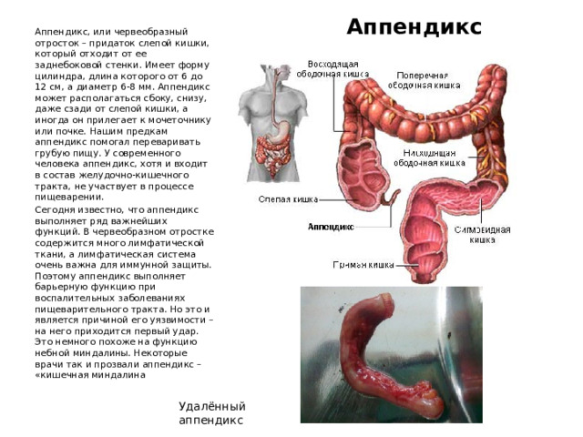 Аппендикс Аппендикс, или червеобразный отросток – придаток слепой кишки, который отходит от ее заднебоковой стенки. Имеет форму цилиндра, длина которого от 6 до 12 см, а диаметр 6-8 мм. Аппендикс может располагаться сбоку, снизу, даже сзади от слепой кишки, а иногда он прилегает к мочеточнику или почке. Нашим предкам аппендикс помогал переваривать грубую пищу. У современного человека аппендикс, хотя и входит в состав желудочно-кишечного тракта, не участвует в процессе пищеварении. Сегодня известно, что аппендикс выполняет ряд важнейших функций. В червеобразном отростке содержится много лимфатической ткани, а лимфатическая система очень важна для иммунной защиты. Поэтому аппендикс выполняет барьерную функцию при воспалительных заболеваниях пищеварительного тракта. Но это и является причиной его уязвимости – на него приходится первый удар. Это немного похоже на функцию небной миндалины. Некоторые врачи так и прозвали аппендикс – «кишечная миндалина Удалённый аппендикс 
