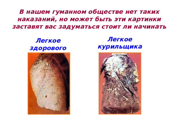 В нашем гуманном обществе нет таких наказаний, но может быть эти картинки заставят вас задуматься стоит ли начинать Легкое курильщика Легкое здорового человека 
