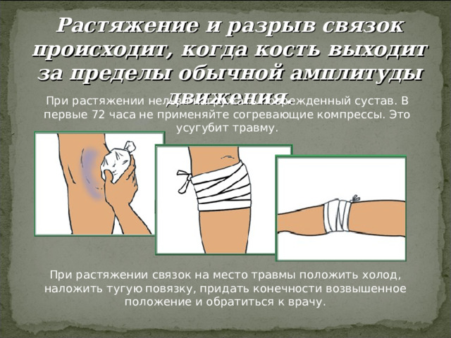Растяжение и разрыв связок происходит, когда кость выходит за пределы обычной амплитуды движения. 