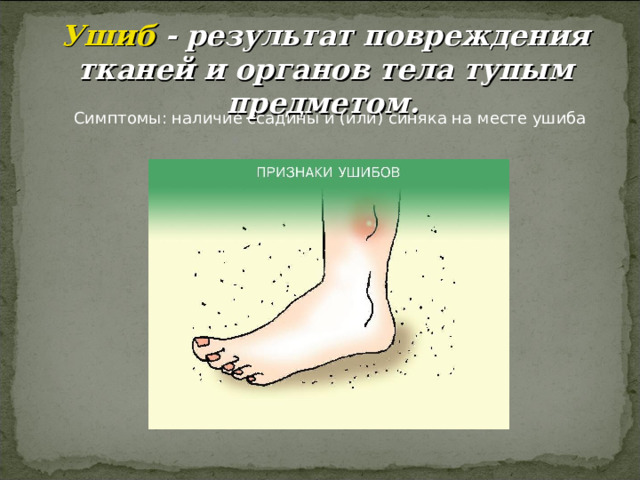 Ушиб - результат повреждения тканей и органов тела тупым предметом. 