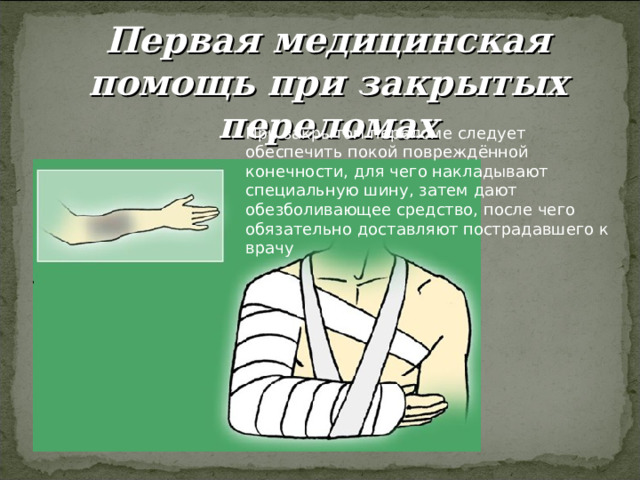 Первая медицинская помощь при закрытых переломах 
