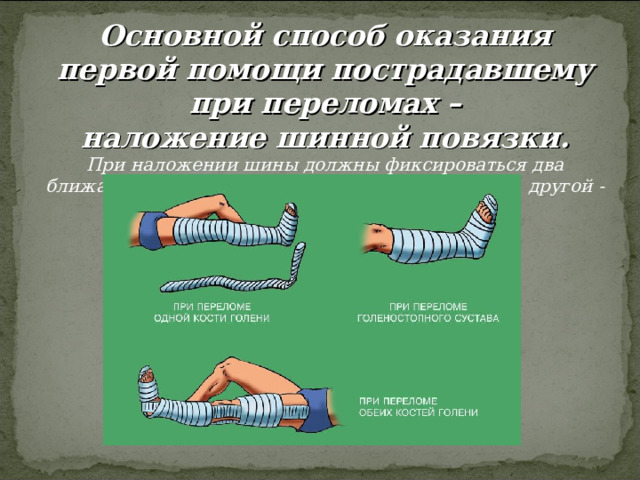 Основной способ оказания первой помощи пострадавшему при переломах –  наложение шинной повязки. При наложении шины должны фиксироваться два ближайших сустава: один - выше места перелома, другой - ниже. 