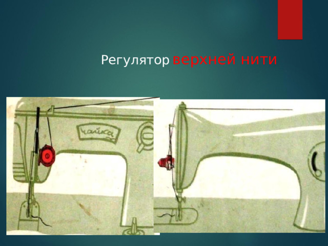 Регулятор  верхней нити 
