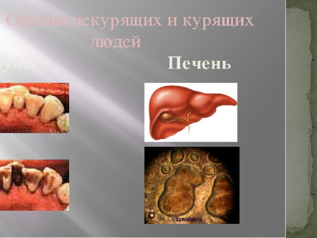 Органы человека курящего и некурящего (Зубы, печень)  
