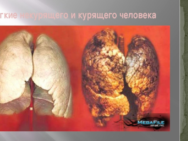 Курение загрязняет легкие, затрудняет нормальную работу мозга.  