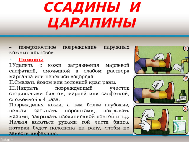 ССАДИНЫ И ЦАРАПИНЫ – поверхностное повреждение наружных кожных покровов.  Помощь: Удалить с кожи загрязнения марлевой салфеткой, смоченной в слабом растворе марганца или перекиси водорода. Смазать йодом или зеленкой края раны. Накрыть поврежденный участок стерильными бинтом, марлей или салфеткой, сложенной в 4 раза. Повреждения кожи, а тем более глубокие, нельзя засыпать порошками, покрывать мазями, закрывать изоляционной лентой и т.д. Нельзя касаться руками той части бинта, которая будет наложена на рану, чтобы не занести инфекцию. 