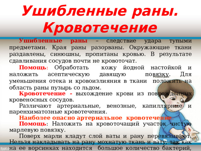 Ушибленные раны. Кровотечение Ушибленные раны – следствие удара тупыми предметами. Края раны разорваны. Окружающие ткани раздавлены, синюшны, пропитаны кровью. В результате сдавливания сосудов почти не кровоточат. Помощь : Обработать кожу йодной настойкой и наложить асептическую давящую повязку. Для уменьшения отека и кровоизлияния в ткани положить на область раны пузырь со льдом. Кровотечение - выхождение крови из поврежденных кровеносных сосудов. Различают артериальные, венозные, капиллярные и паренхиматозные кровотечения. Наиболее опасно артериальное кровотечение . Помощь : Наложить на кровоточащий участок чистую марлевую повязку. Поверх марли кладут слой ваты и рану перевязывают. Нельзя накладывать на рану мохнатую ткань и вату, так как на ее ворсинках находится большое количество бактерий, которые вызывают заражение раны. 