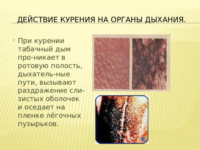 Действие курения на органы дыхания. При курении табачный дым про-никает в ротовую полость, дыхатель-ные пути, вызывают раздражение сли-зистых оболочек и оседает на пленке лёгочных пузырьков. 
