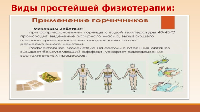 Виды простейшей физиотерапии: 