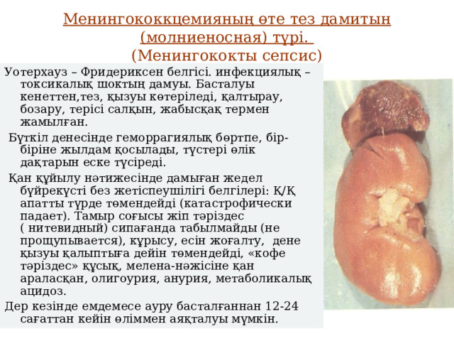 Менингококкцемияның өте тез дамитын (молниеносная) түрі.  (Менингококты сепсис) Уотерхауз – Фридериксен белгісі. инфекциялық – токсикалық шоктың дамуы. Басталуы кенеттен,тез, қызуы көтеріледі, қалтырау, бозару, терісі салқын, жабысқақ термен жамылған.  Бүткіл денесінде геморрагиялық бөртпе, бір-біріне жылдам қосылады, түстері өлік дақтарын еске түсіреді.  Қан құйылу нәтижесінде дамыған жедел бүйрекүсті без жетіспеушілігі белгілері: Қ/Қ апатты түрде төмендейді (катастрофически падает). Тамыр соғысы жіп тәріздес ( нитевидный) сипағанда табылмайды (не прощупывается), кұрысу, есін жоғалту, дене  қызуы қалыптыға дейін төмендейді, «кофе тәріздес» құсық, мелена-нәжісіне қан араласқан, олигоурия, анурия, метаболикалық ацидоз. Дер кезінде емдемесе ауру басталғаннан 12-24 сағаттан кейін өліммен аяқталуы мүмкін. 