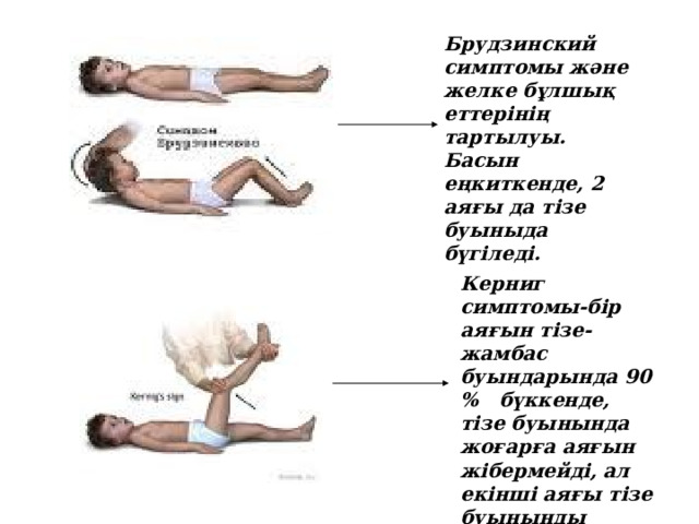 Брудзинский симптомы және желке бұлшық еттерінің тартылуы. Басын еңкиткенде, 2 аяғы да т i зе буыныда бүгіледі. Керниг симптомы-бір аяғын тізе-жамбас буындарында 90 % бүккенде, т i зе буынында жоғарға аяғын жібермейді, ал екінші аяғы т i зе буынынды бүгіледі. 