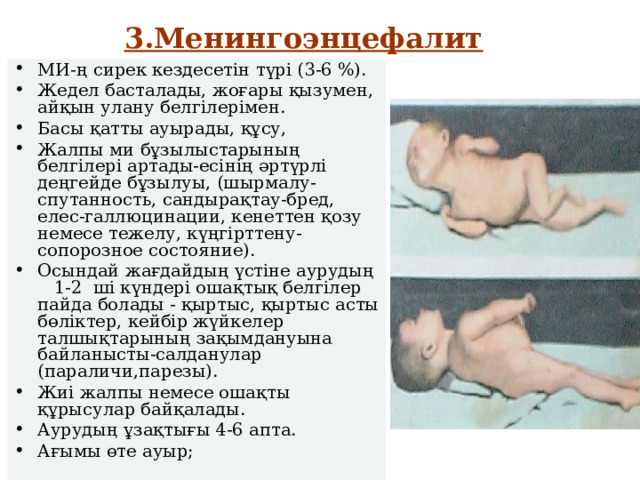 3.Менингоэнцефалит МИ-ң сирек кездесетін түрі (3-6 %). Жедел басталады, жоғары қызумен, айқын улану белгілерімен. Басы қатты ауырады, құсу, Жалпы ми бұзылыстарының белгілері артады-есінің әртүрлі деңгейде бұзылуы, (шырмалу-спутанность, сандырақтау-бред, елес-галлюцинации, кенеттен қозу немесе тежелу, күңгірттену-сопорозное состояние). Осындай жағдайдың үстіне аурудың 1-2 ші күндері ошақтық белгілер пайда болады - қыртыс, қыртыс асты бөліктер, кейбір жүйкелер талшықтарының зақымдануына байланысты-салданулар (параличи,парезы). Жиі жалпы немесе ошақты құрысулар байқалады. Аурудың ұзақтығы 4-6 апта. Ағымы өте ауыр; 