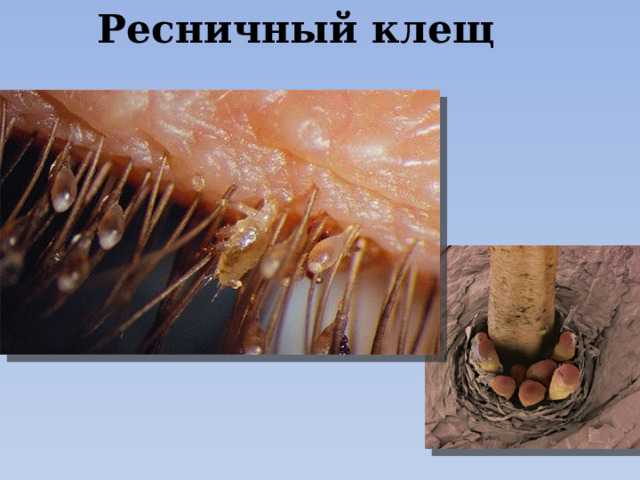 Ресничный клещ 