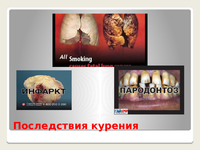 Последствия курения 