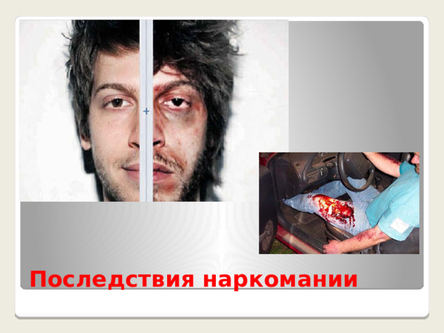 Последствия наркомании 