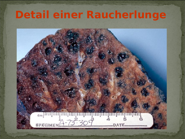 Detail einer Raucherlunge  