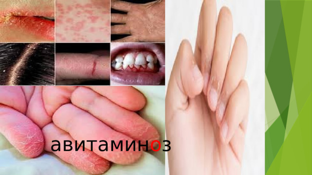 авитамин о з 
