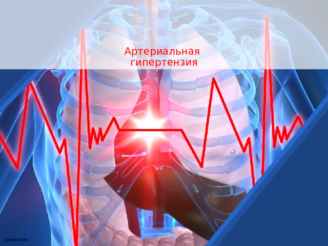     Артериальная  гипертензия 