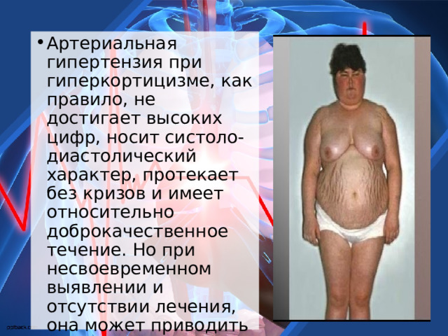 Артериальная гипертензия при гиперкортицизме, как правило, не достигает высоких цифр, носит систоло-диастолический характер, протекает без кризов и имеет относительно доброкачественное течение. Но при несвоевременном выявлении и отсутствии лечения, она может приводить к сосудистым осложнениям и смерти.  