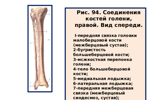 Рис. 94. Соединения костей голени, правой. Вид спереди.   I-передняя связка головки малоберцовой кости (межберцовый сустав); 2-бугристость большеберцовой кости; 3-мсжкостная перепонка голени; 4-тело большеберцовой кости; 5-медиальная лодыжка; 6-латеральная лодыжка; 7-передняя межберцовая связка (межберцовый синдесмоз, сустав); 8-тело малоберцовой кости. 