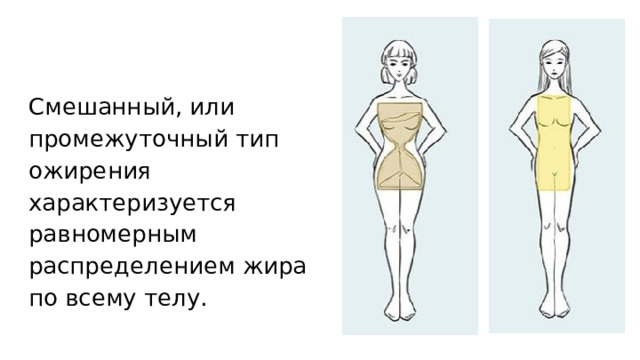 Смешанный, или промежуточный тип ожирения характеризуется равномерным распределением жира по всему телу. 