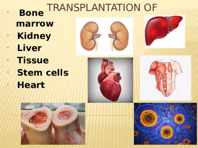 Transplantation of  Bone marrow Kidney Liver Tissue Stem cells Heart 