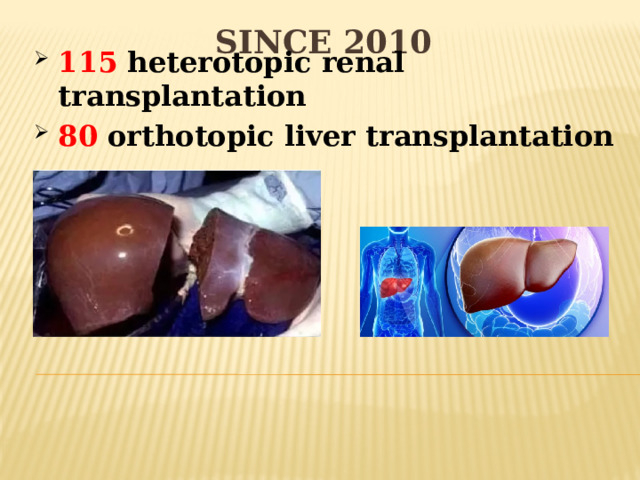 Since 2010 115 heterotopic renal transplantation 80 orthotopic liver transplantation 