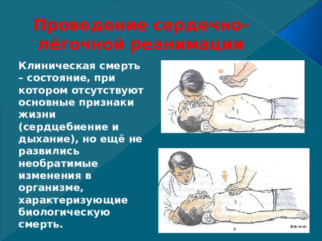 Проведение сердечно-лёгочной реанимации Клиническая смерть – состояние, при котором отсутствуют основные признаки жизни (сердцебиение и дыхание), но ещё не развились необратимые изменения в организме, характеризующие биологическую смерть. 