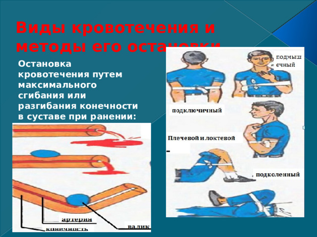 Виды кровотечения и методы его остановки. Остановка кровотечения путем максимального  сгибания или разгибания конечности в суставе при ранении:  предплечья; плеча; голени; бедра 