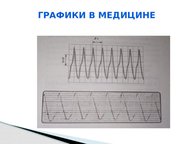 Графики в медицине 