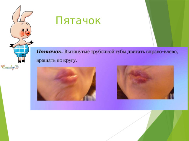 Пятачок 