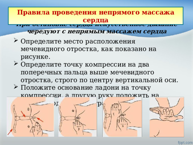 Правила проведения непрямого массажа сердца При остановке сердца искусственное дыхание чередуют с непрямым массажем сердца Определите место расположения мечевидного отростка, как показано на рисунке. Определите точку компрессии на два поперечных пальца выше мечевидного отростка, строго по центру вертикальной оси. Положите основание ладони на точку компрессии, а другую руку положить на первую под углом 90 градусов. 