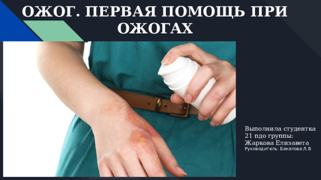 ОЖОГ. ПЕРВАЯ ПОМОЩЬ ПРИ ОЖОГАХ Выполнила студентка 21 пдо группы: Жаркова Елизавета  Руководитель: Бакалова Л.В 