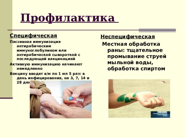 Профилактика Специфическая Пассивная иммунизация антирабическим иммуноглобулином или антирабической сывороткой с последующей вакцинацией Активную иммунизацию начинают немедленно Вакцину вводят в/м по 1 мл 5 раз: в день инфицирования, на 3, 7, 14 и 28 день Неспецифическая  Местная обработка раны: тщательное промывание струей мыльной воды, обработка спиртом 