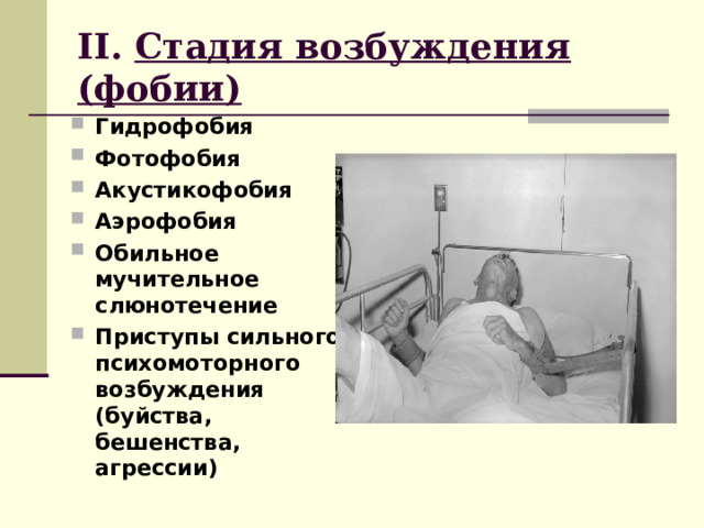 II . Стадия возбуждения (фобии) Гидрофобия Фотофобия Акустикофобия Аэрофобия Обильное мучительное слюнотечение Приступы сильного психомоторного возбуждения (буйства, бешенства, агрессии) 