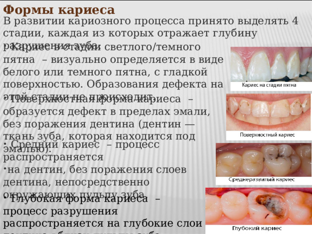 Формы кариеса   В развитии кариозного процесса принято выделять 4 стадии, каждая из которых отражает глубину разрушения зуба:  Кариес в стадии светлого/темного пятна  – визуально определяется в виде белого или темного пятна, с гладкой поверхностью. Образования дефекта на этой стадии не происходит.  Поверхностная форма кариеса  – образуется дефект в пределах эмали, без поражения дентина (дентин — ткань зуба, которая находится под эмалью).  Средний кариес  – процесс распространяется на дентин, без поражения слоев дентина, непосредственно окружающих пульпу зуба.  Глубокая форма кариеса  – процесс разрушения распространяется на глубокие слои дентина вблизи пульпы зуба. 