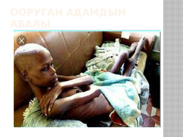 Ооруган адамдын абалы 