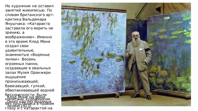 Но художник не оставил занятий живописью. По словам британского арт-критика Вальдемара Янушчака: «Катаракта заставила его верить не зрению, а воображению». Именно в это время Клод Моне создал свои удивительные, знаменитые «Водяные лилии». Восемь огромных панно, создающие в овальных залах Музея Оранжери ощущение пронизывающей, баюкающей, гулкой, обволакивающей водной бесконечности, были написаны художником без хрусталика в правом глазу и с катарактой на левом. Клод Моне на фоне своих картин Водяные лилии(1923) 