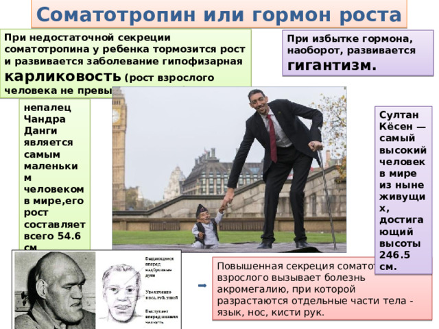 Соматотропин или гормон роста При недостаточной секреции соматотропина у ребенка тормозится рост и развивается заболевание гипофизарная карликовость (рост взрослого человека не превышает 130 см). При избытке гормона, наоборот, развивается гигантизм. непалец Чандра Данги является самым маленьким человеком в мире,его рост составляет всего 54.6 см Султан Кёсен — самый высокий человек в мире из ныне живущих, достигающий высоты 246.5 см. Повышенная секреция соматотропина у взрослого вызывает болезнь акромегалию, при которой разрастаются отдельные части тела - язык, нос, кисти рук. 