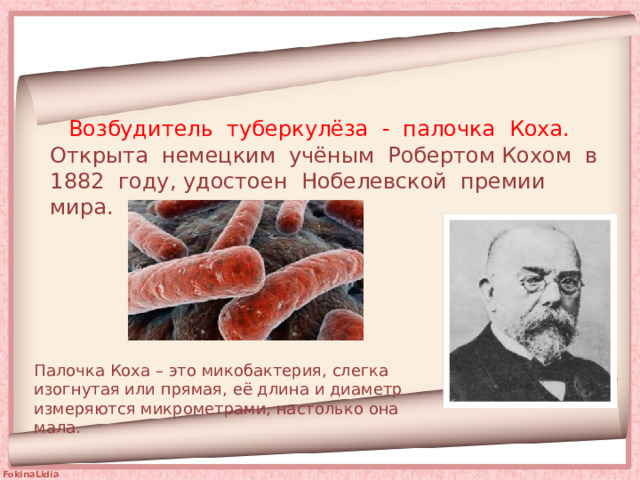   Возбудитель туберкулёза - палочка Коха. Открыта немецким учёным Робертом Кохом в 1882 году, удостоен Нобелевской премии мира.   Палочка Коха – это микобактерия, слегка изогнутая или прямая, её длина и диаметр измеряются микрометрами, настолько она мала. 