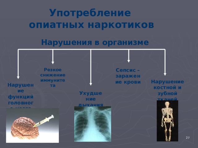 Употребление  опиатных наркотиков Нарушения в организме Резкое снижение иммунитета Сепсис – заражение крови Нарушение костной и зубной тканей Нарушение функций головного мозга Ухудшение дыхания 4 