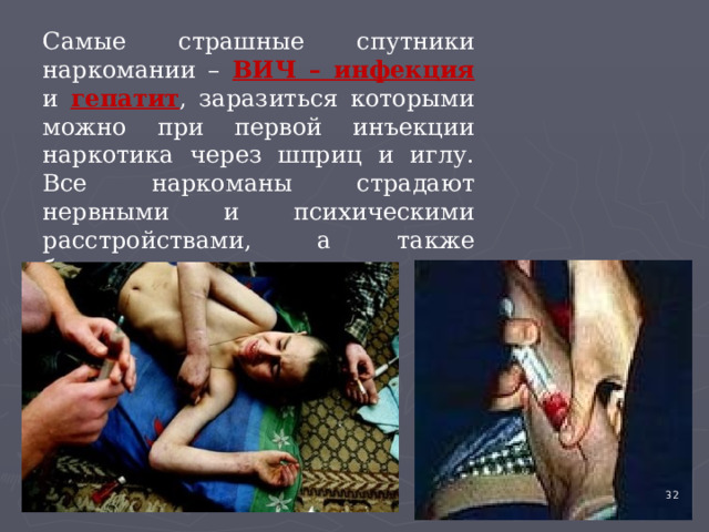 Самые страшные спутники наркомании – ВИЧ – инфекция  и гепатит , заразиться которыми можно при первой инъекции наркотика через шприц и иглу. Все наркоманы страдают нервными и психическими расстройствами, а также бесплодием. 4 