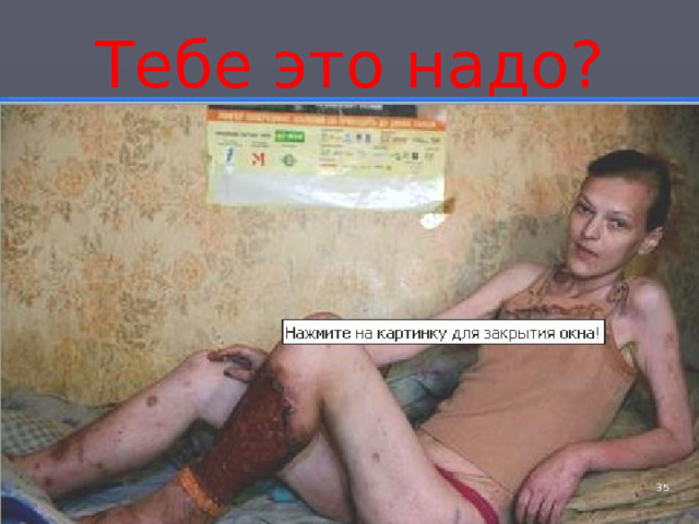 Тебе это надо? 4 
