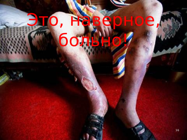 Это, наверное, больно! 4 