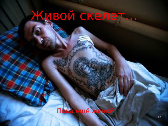 Живой скелет… Пока ещё живой! 4 