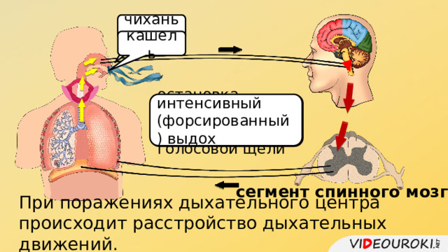 чиханье кашель интенсивный (форсированный) выдох остановка дыхания и смыкание голосовой щели сегмент спинного мозга При поражениях дыхательного центра происходит расстройство дыхательных движений. 