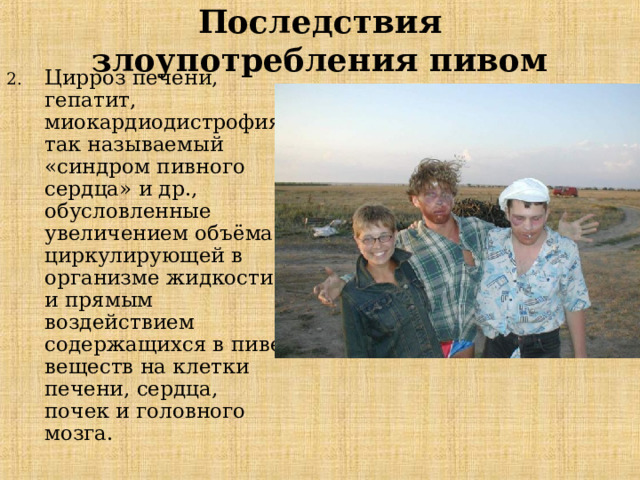 Последствия злоупотребления пивом Ц ирроз печени, гепатит, миокардиодистрофия так называем ый «синдром пивного сердца» и др., обусловленные увеличением объёма циркулирующей в организме жидкости и прямым воздействием содержащихся в пиве веществ на клетки печени, сердца, почек и головного мозга.  