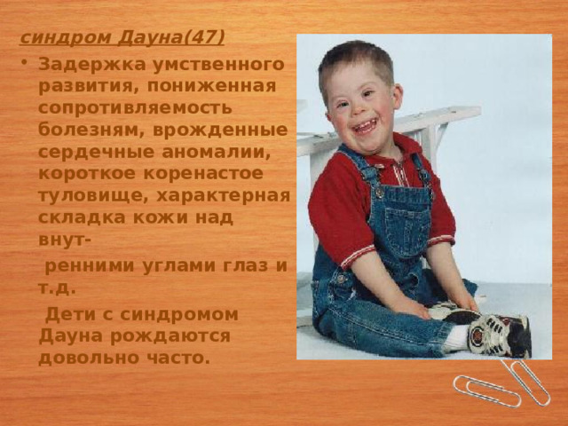 синдром Дауна(47) Задержка умственного развития, пониженная сопротивляемость болезням, врожденные сердечные аномалии, короткое коренастое туловище, характерная складка кожи над внут-  ренними углами глаз и т.д.  Дети с синдромом Дауна рождаются довольно часто. 